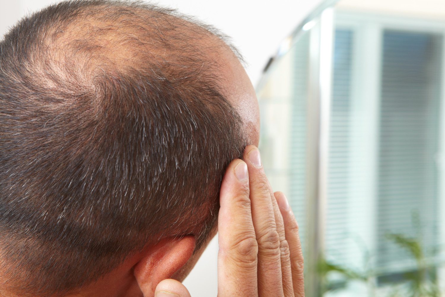 Possible Cure For Baldness Discovered - Simplemost