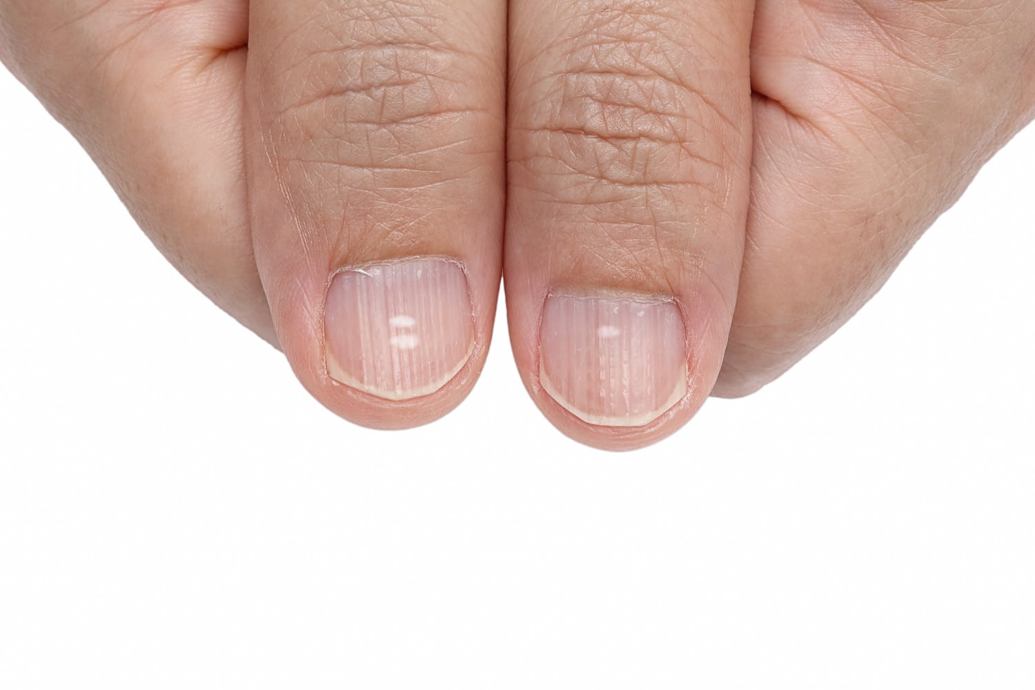 This Change In Your Fingernails Could Be A Sign Of Lung Cancer Wral Com
