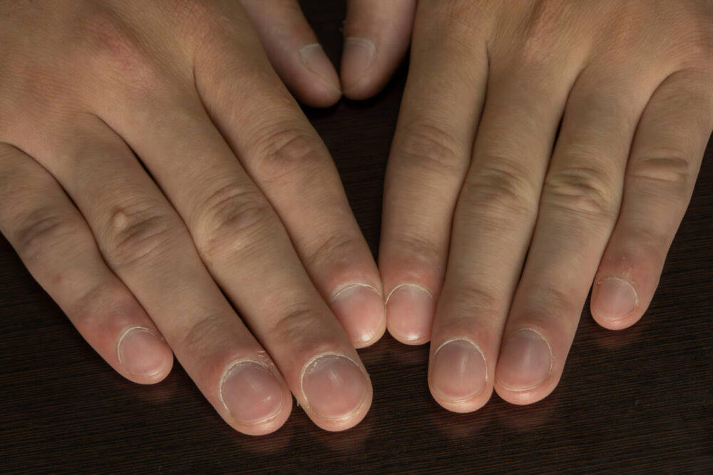 close-up of fingernails 