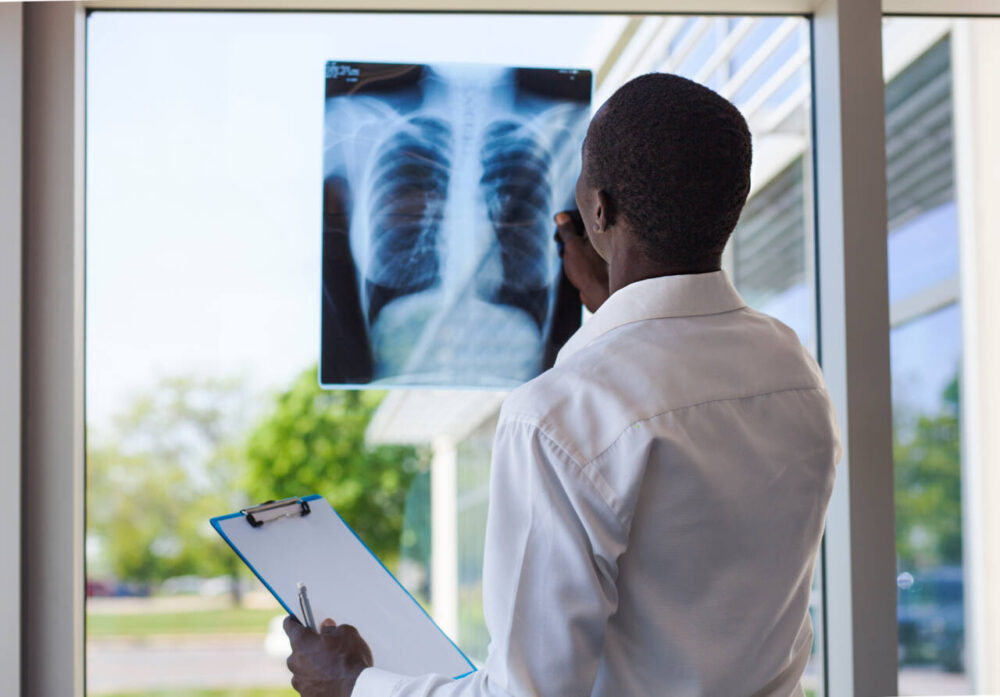 man looks at lung x-ray