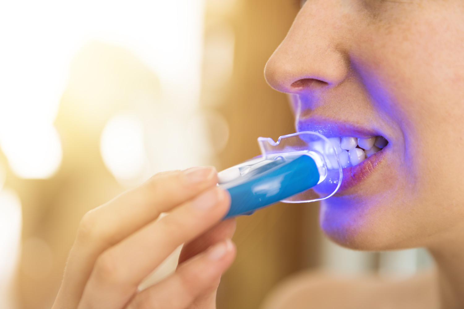 Blanqueador dental: ¿cuál es el mejor modelo en 2023?