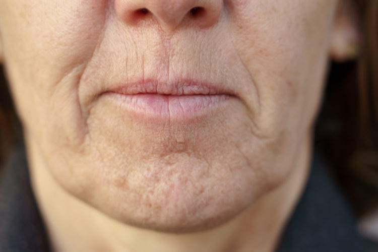 Why Those Wiry Hairs Suddenly Appear On Your Chin Simplemost