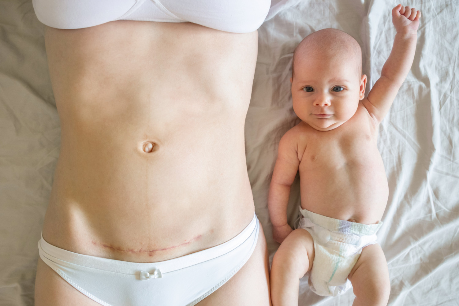 Why Feeding C-Section Newborns A Bit Of Mom’s Poop May Boost Immune Health 