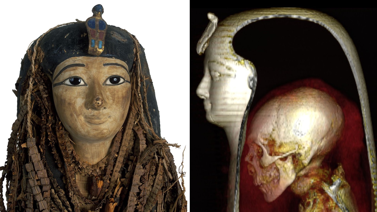 Mummy digitally 'unwrapped' by CT scan