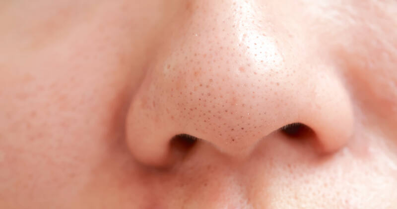 close up of blackheads on asian woman nose
